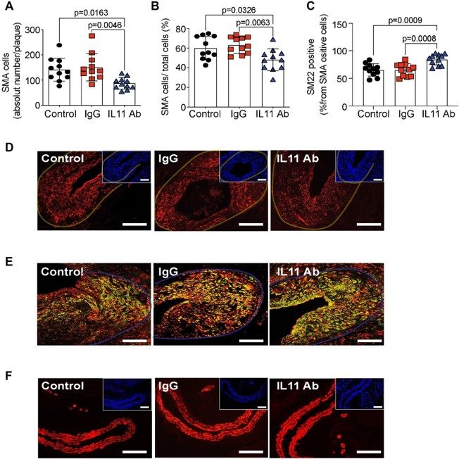 Anti-IL-11 antibody treatment reduced post-endothelial injury VSMC accumulation. (OA Literature)