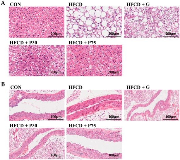 PEITC supplementation significantly ameliorated HFD & CHOL/HFCD-induced aorta and hepatic injury in C57BL/6 mice. (OA Literature)