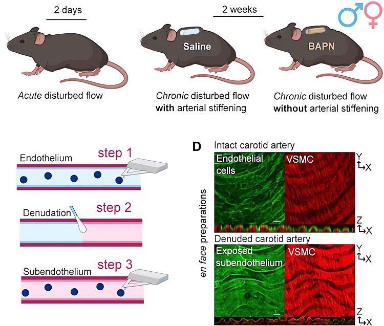 LCA for determining the effects of d-flow on the mechanical phenotype of the endothelium and subendothelial matrix. (OA Literature)