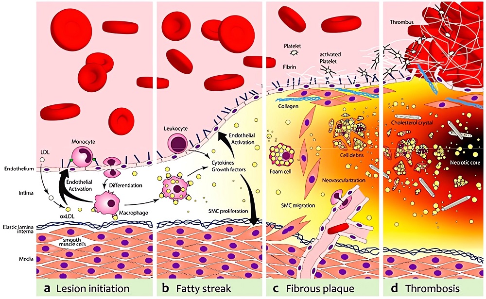 Schematic depiction of representative targets for molecular imaging of atherosclerosis and plaque vulnerability in animal models. (OA Literature)