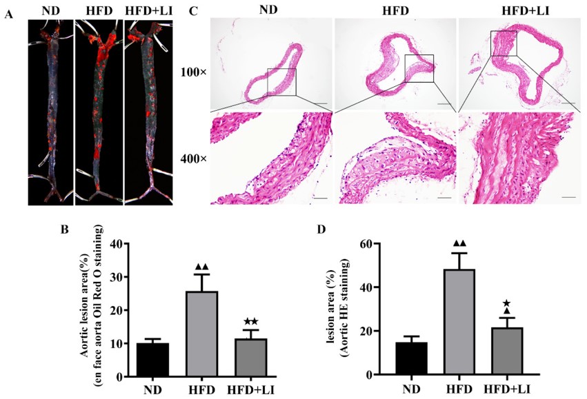 Low-iron diet improves atherosclerosis in ApoE KO mice. (OA Literature)