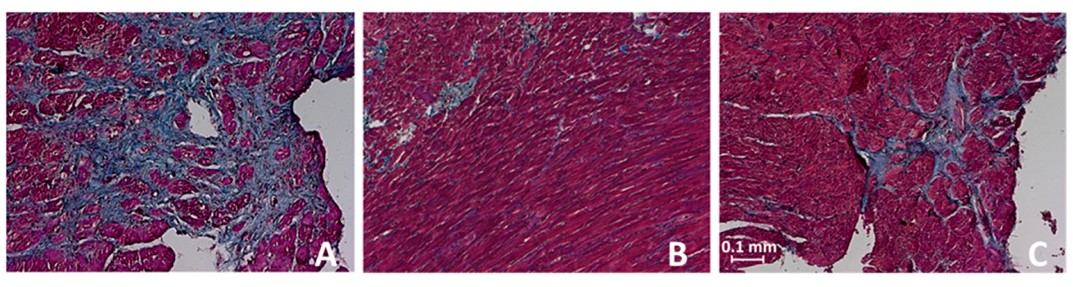 Histological manifestation of cardiac fibrosis in untreated control and treated SHR. (OA Literature)