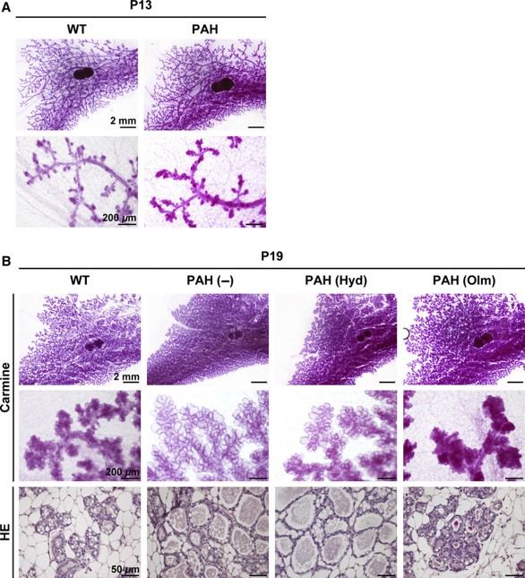 Whole mount carmine staining and hematoxylin–eosin staining of the lobuloalveolar structure of mammary gland in PAH mice. (OA Literature)