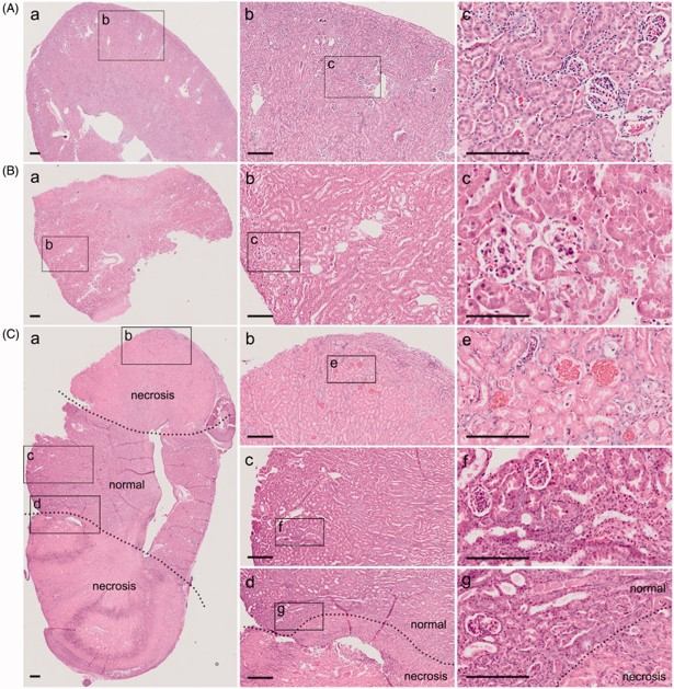Unilateral kidney ligation simulates conventional 5/6 Nx. (OA Literature)