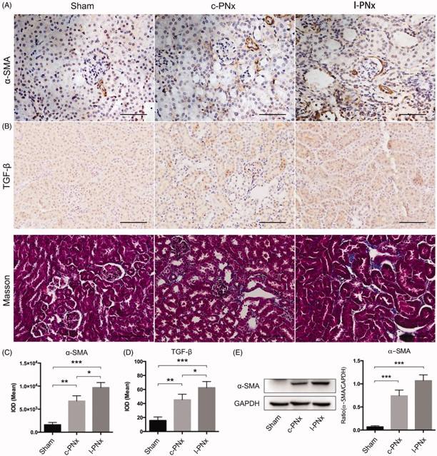 Unilateral kidney ligation based on 5/6 Nx can induce kidney fibrosis at 4 weeks post-operation. (OA Literature)