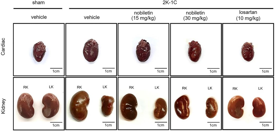Representative images of the hearts (upper panel) and kidneys (lower panel) of 2K-1C rats after 7 weeks of the experiment. (OA Literature)