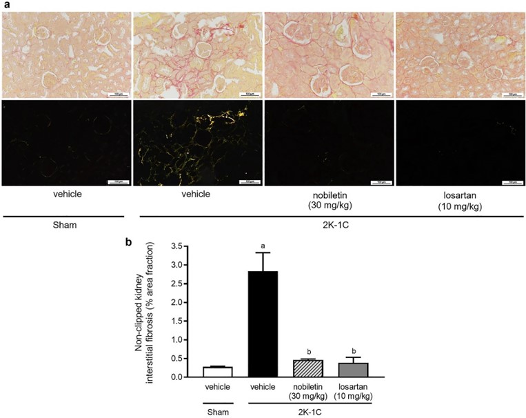 Effects of nobiletin on kidney morphology. (OA Literature)