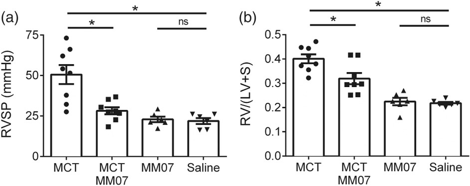 MM07 attenuated the development of PAH in MCT-exposed rats. (OA Literature)