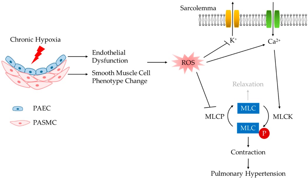 Chronic hypoxia-induced functional alterations of endothelial and smooth muscle cells contribute to PH. (OA Literature)