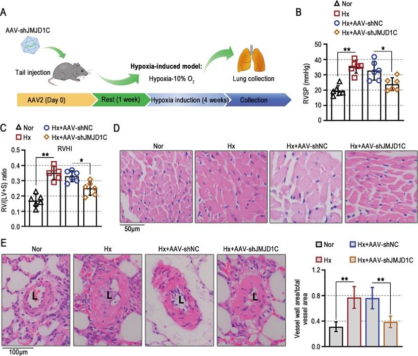 JMJD1C knockdown attenuates pathological changes in mice exposed to hypoxia. (OA Literature)