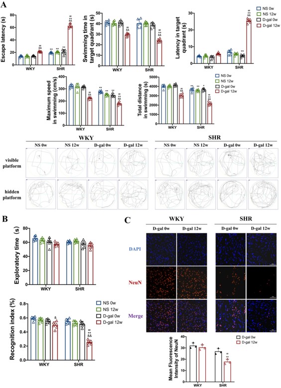 Aging exacerbates cognitive dysfunction caused by hypertension. (OA Literature)