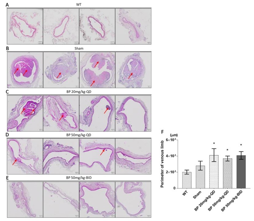 BP inhibited thrombosis and neointimal hyperplasia in an AVF rat model. (OA Literature)