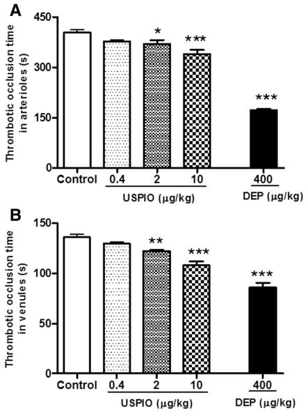 Thrombotic occlusion time in pial arterioles or venules 1 h after the intravenous administration of USPIO in mice. (OA Literature)