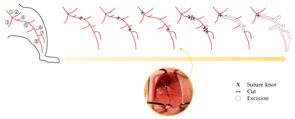 Surgical procedures for femoral artery ligation strategies. (OA Literature)