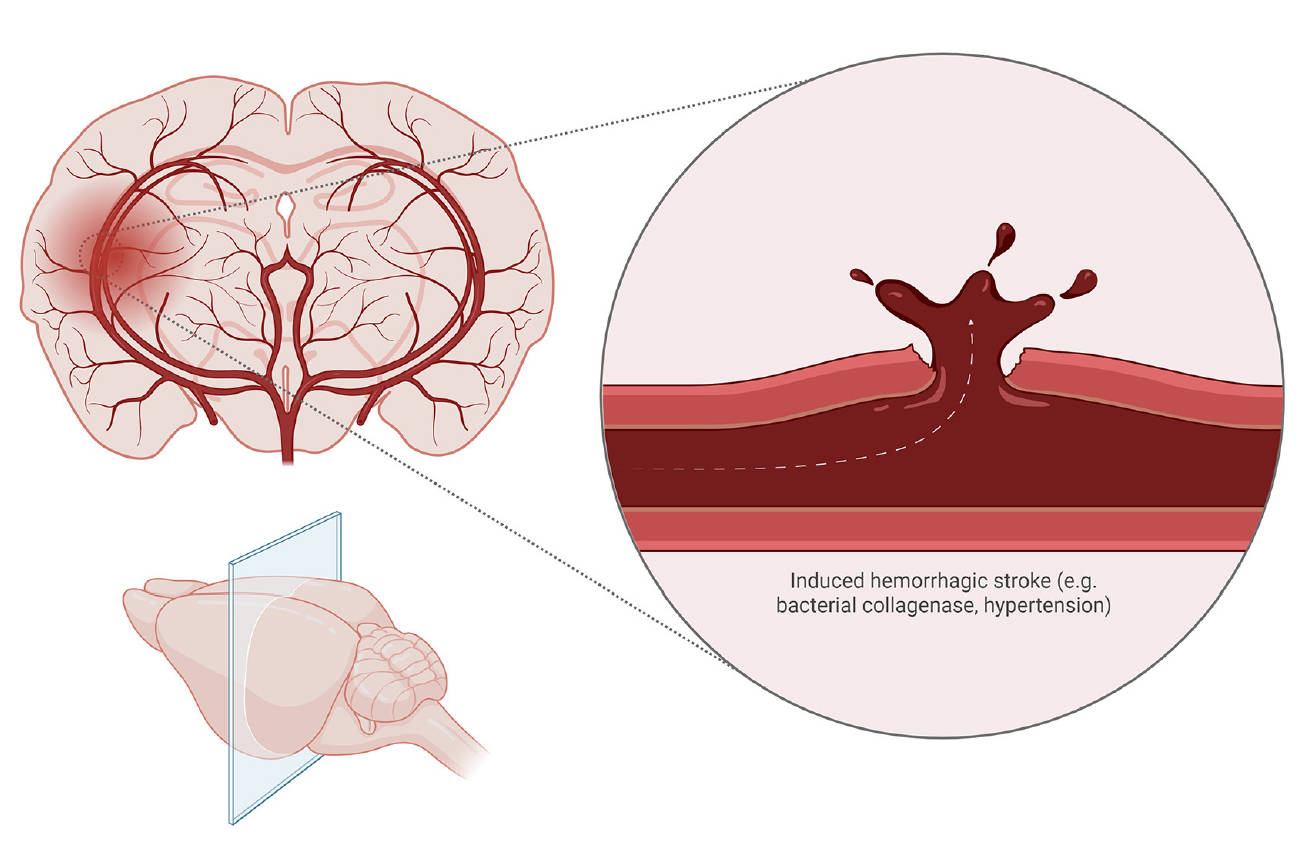 Schematic representation of stroke animal model. (OA Literature)
