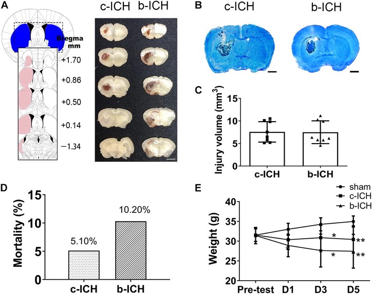 The comparison of BBB breakdown between the c-ICH and the b-ICH groups. (OA Literature)