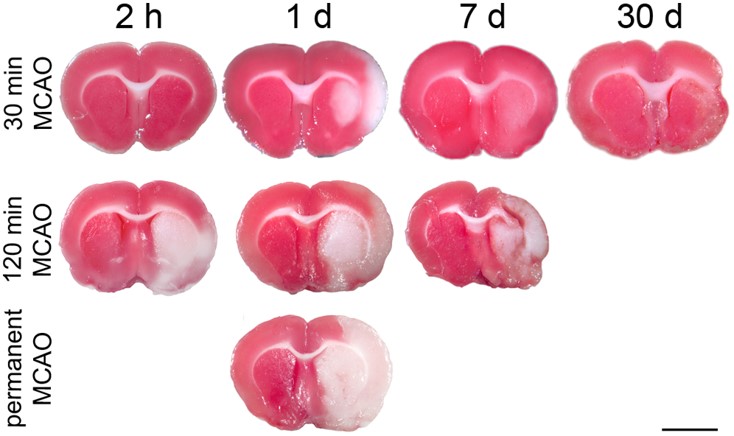 TTC-stained brain sections at various reperfusion times following transient (30 min and 120 min) and permanent MCAO. (OA Literature)