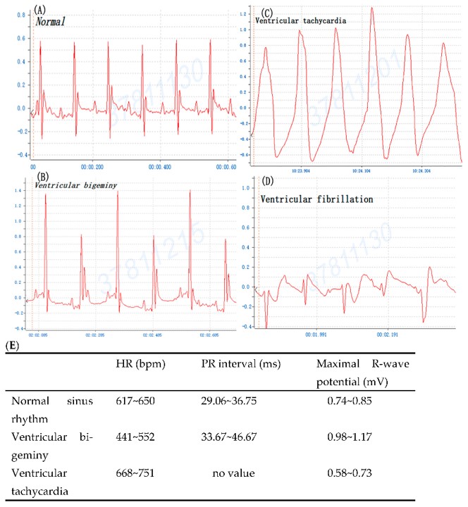 The typical profile of mouse cardiogram prior to and after BaCl2 induction. (OA Literature)