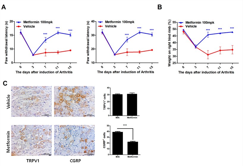 Metformin reduces pain in monosodium iodoacetate (MIA)-induced OA rats. (OA Literature)