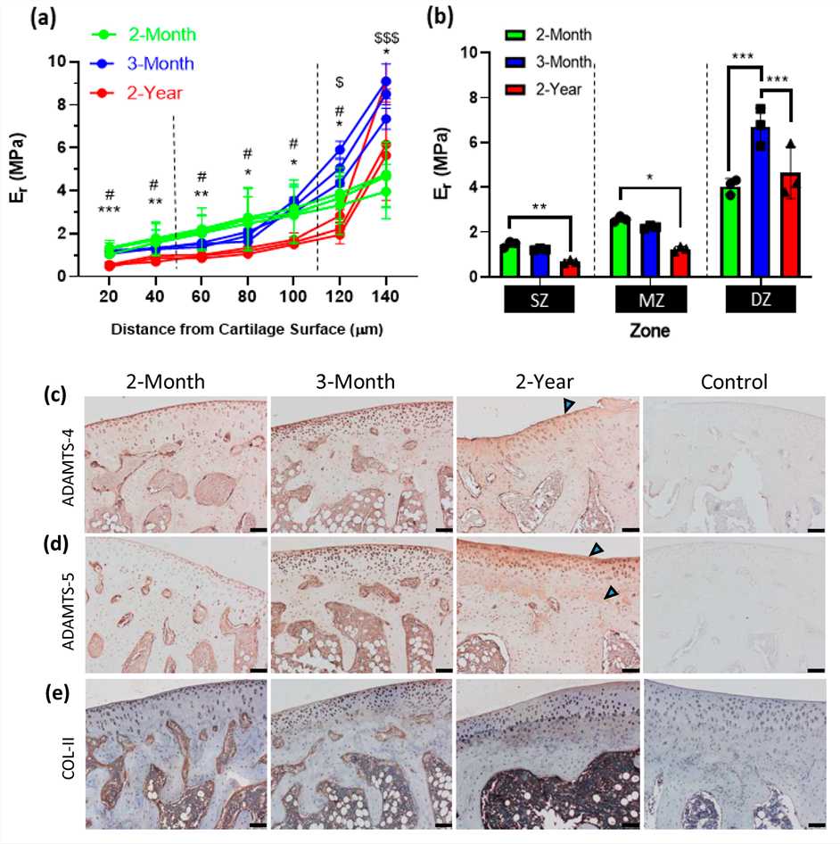 Fig.2 Mechanical properties of articular cartilage. (OA Literature)