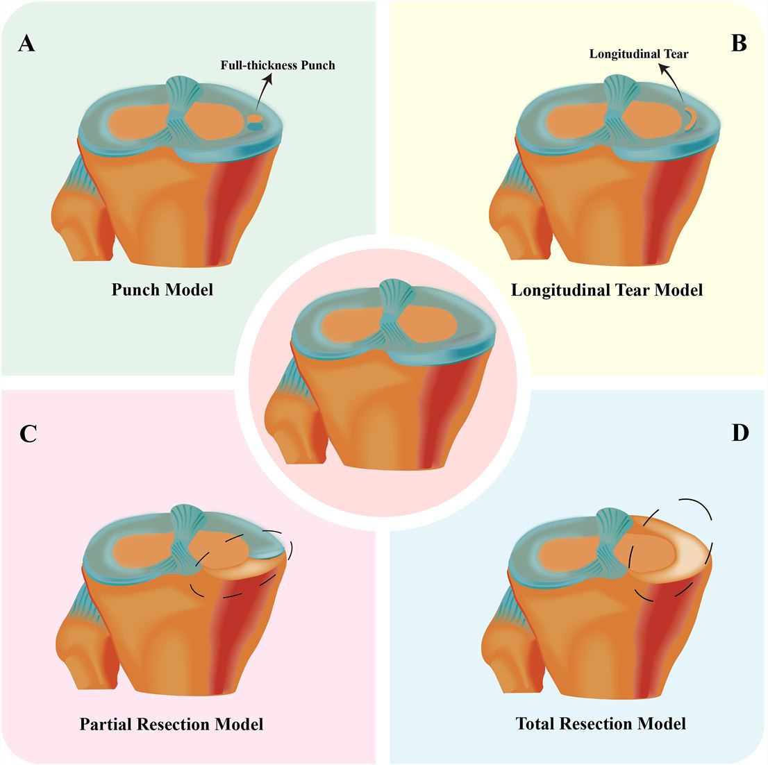 Fig.1 Surgical modeling animal model, including 4 MNX models. (OA Literature)