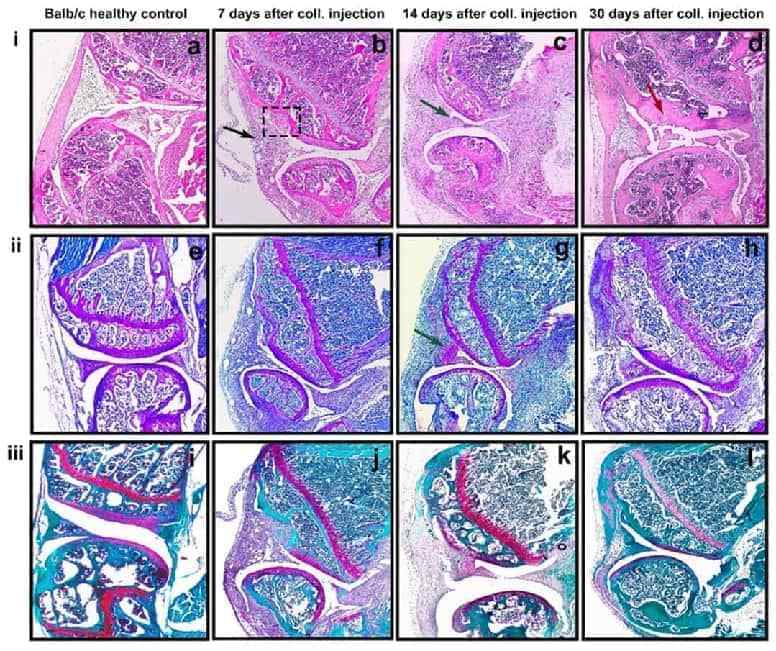 Histologic features of the knee joint after intra-articular injection of collagenase type IA. (OA Literature)