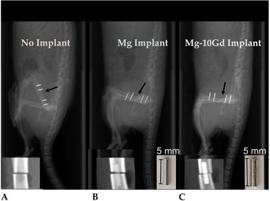 Post-operative in vivo X-ray imaging for three groups. (OA Literature)