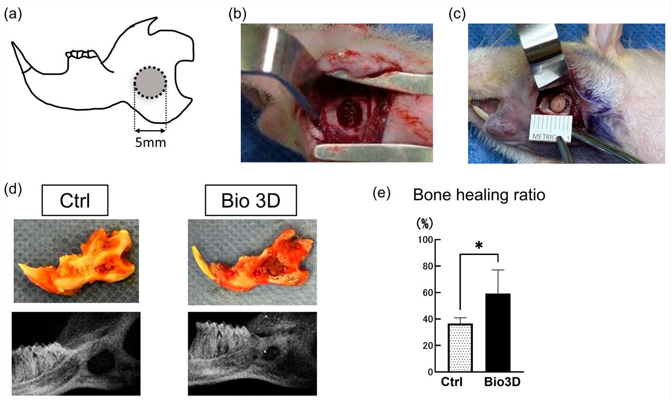 Fig.1 Transplantation of DPSC-derived 3D structures into immunocompromised rat mandible models and two-dimensional (2D) radiographic analysis 8 weeks post-transplantation, (OA Literature)