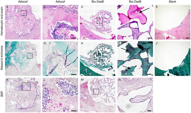 Fig.2 Histological analysis after in vivo implantation. (OA Literature)
