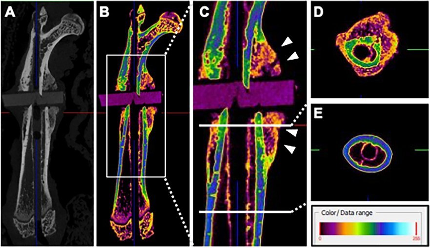 Fig.2 Micro-CT (μCT) images of the femur three weeks after the first operation. (OA Literature)