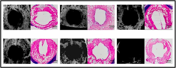 Fig.2 Bone formation at week 12 in the sham defects of cranial defects (X-ray and histological overviews). (OA Literature)