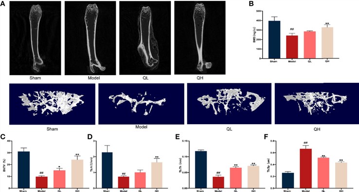 Fig.1 Quercetin induced improvement of bone microstructure in mice that underwent orchiectomy. (OA Literature)