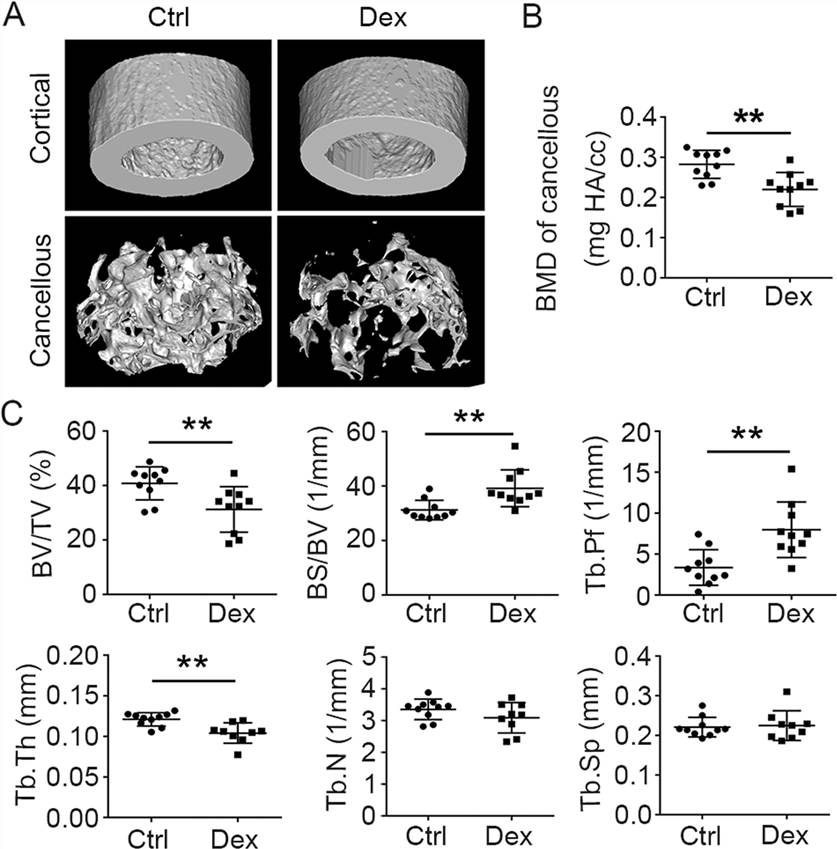 Fig.2 Micro-CT analysis of femoral bones from WT mice treated with or without Dex. (OA Literature)