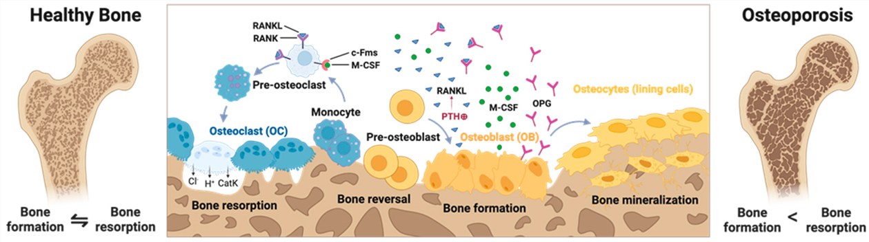 Fig.1 On the left is a cross-section of a healthy bone in which bone formation and resorption are in balance so that bone density and strength are maintained. (OA Literature)