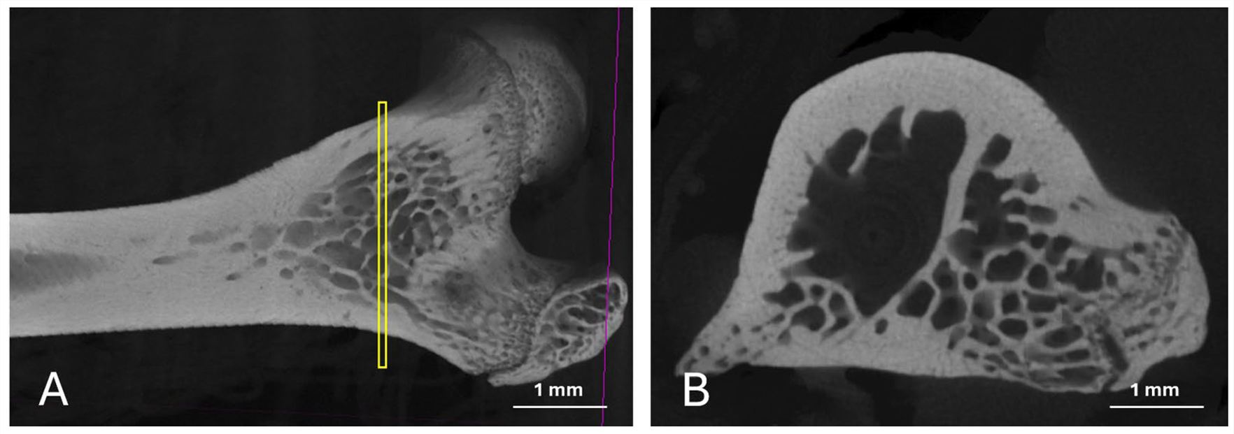 Fig.2 Representative images showing the sagittal cut position used to count trabeculae and assess density. (OA Literature)