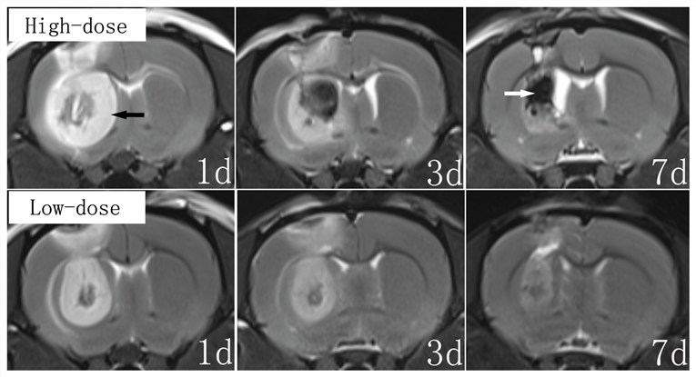 Fig.1 7.0-T MRI examinations after 3-NP injection. (OA Literature)