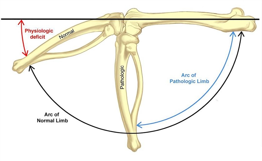 Fig.1 Measurement schema for normal and pathological rat hind limbs. (OA Literature)