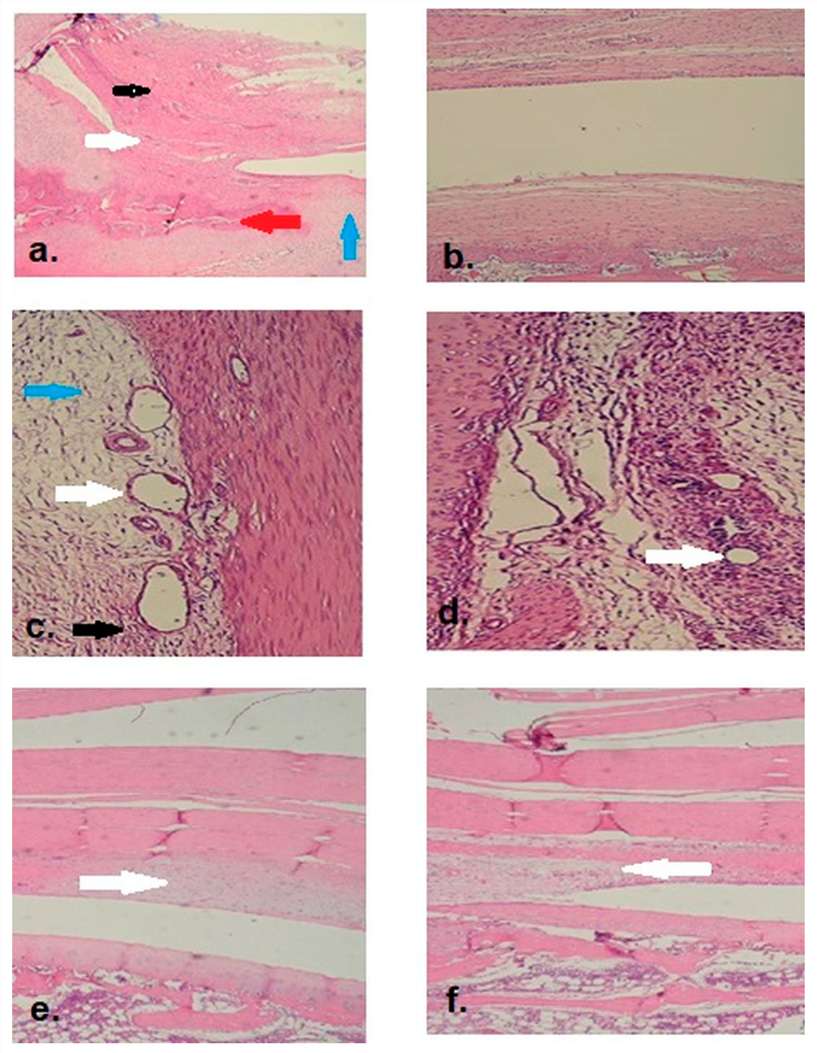 Fig.2 H&E staining reveals that treatment group rabbits maintained complete knee joint mobility, while control group rabbits showed limited movement. (OA Literature)