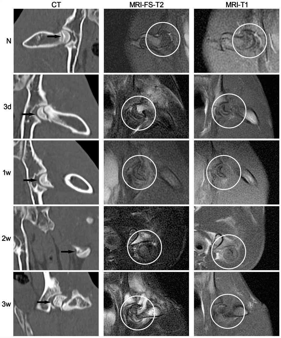 Conventional CT and MR examination of the traumatic ONFH rabbit model established in this study. (OA Literature)