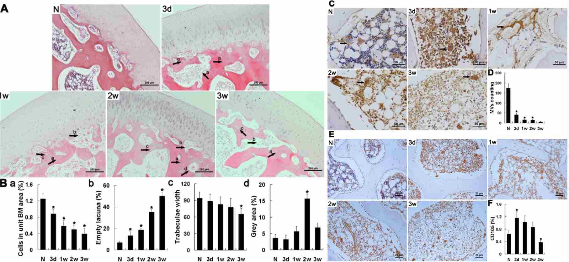 Histopathological images of the traumatic ONFH rabbit model, and immunohistochemical staining and semi-quantitative analysis of vWF and CD105. (OA Literature)