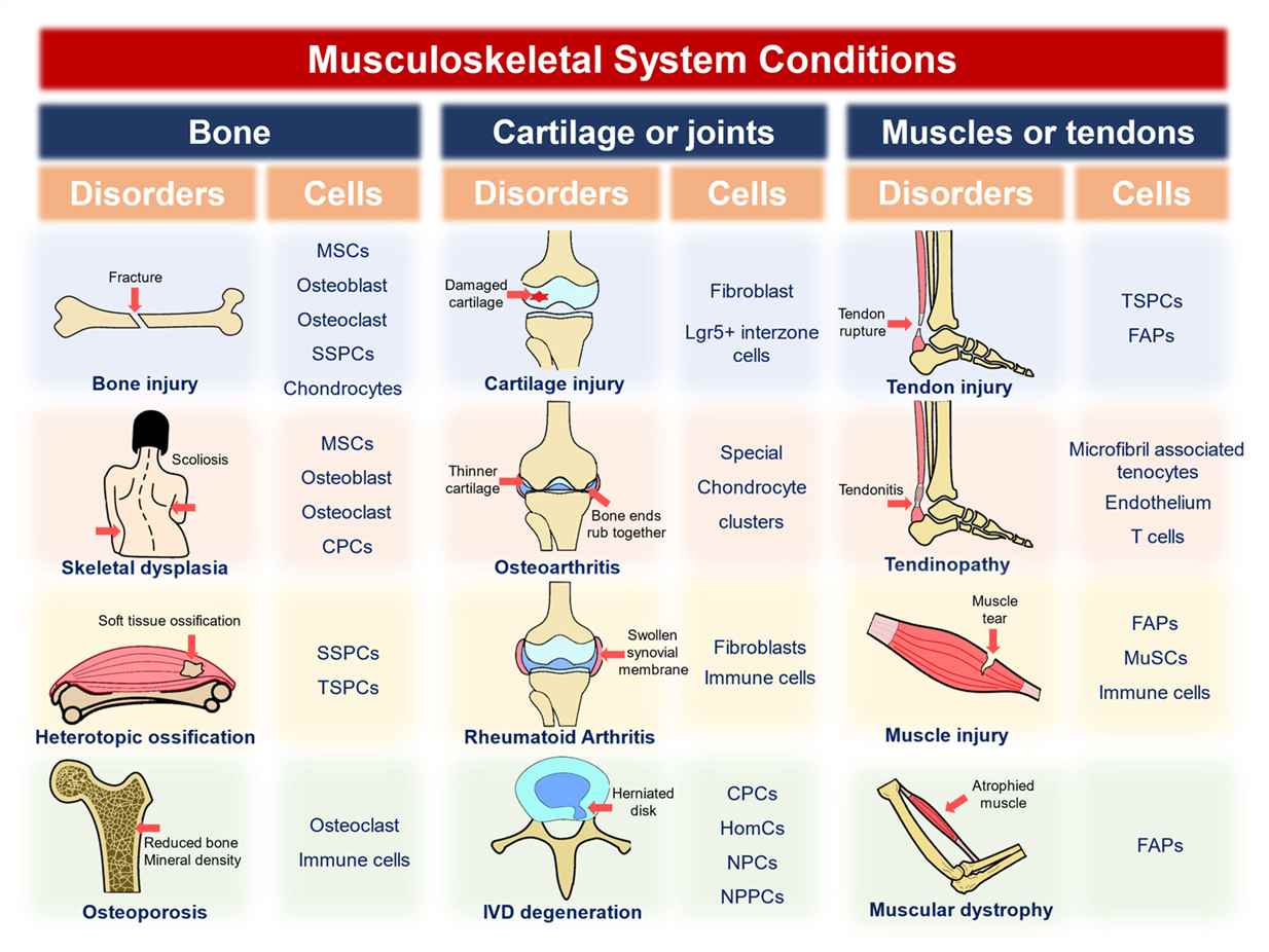 Fig.1 Schematic diagram of Musculoskeletal system conditions and the cell populations. (OA Literature)