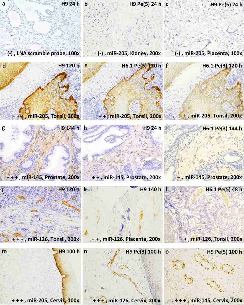 Fig.5 In situ miRNAs hybridization images of the rating scale. 4