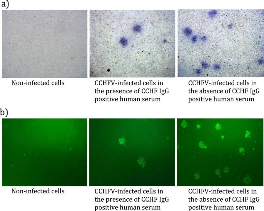 Fig.2 Vero E6 cells infected with CCHFV Turkey-Kelkit06 under light microscopy (×40). (Canakoglu, et al., 2013)