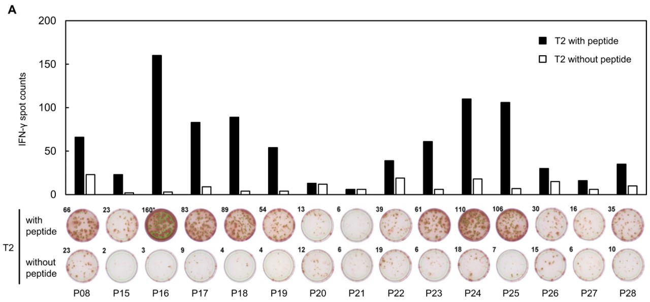 Fig.3 IFN-γ ELISPOT assay was performed after in vitro CTL induction. (Hikichi, et al., 2022)