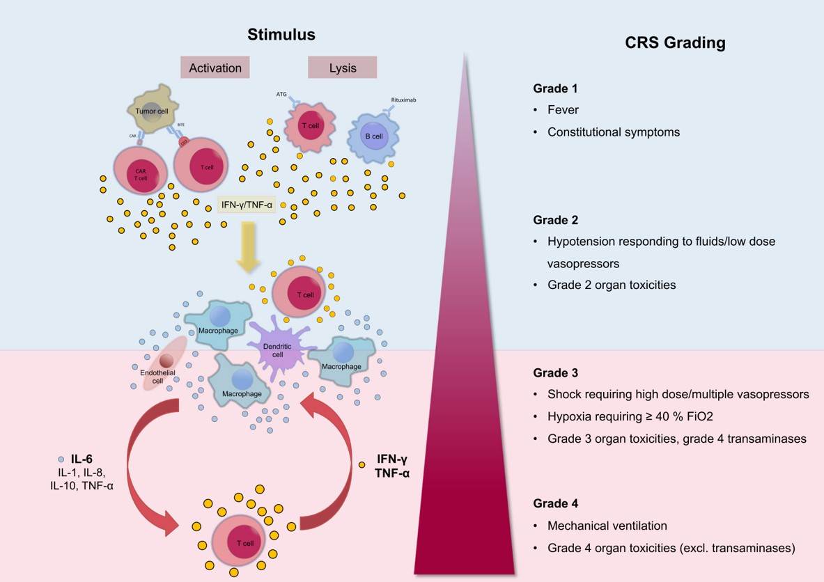 Fig.1 Proposed pathomechanism of CRS. (Shimabukuro-Vornhagen, et al., 2018)