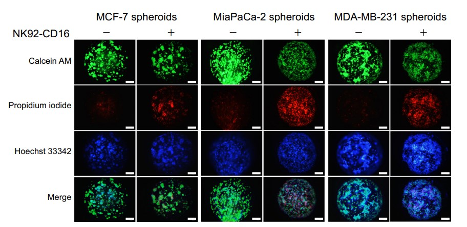 3D tumor spheroids killing assay (E: T = 10: 1).