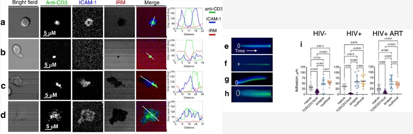 Diverse synaptic interfaces established from Human polyclonal CD8 T cells with lipid bilayers.