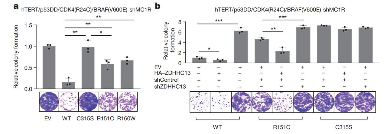 MC1R palmitoylation in cells infected with shZDHHC13 and/or WT HA-ZDHHC13 virus