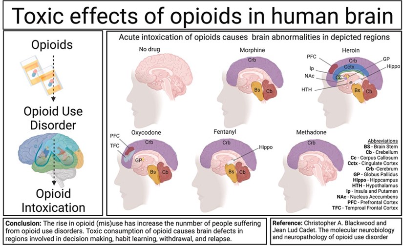 The role of opioid receptors in physiology and addiction