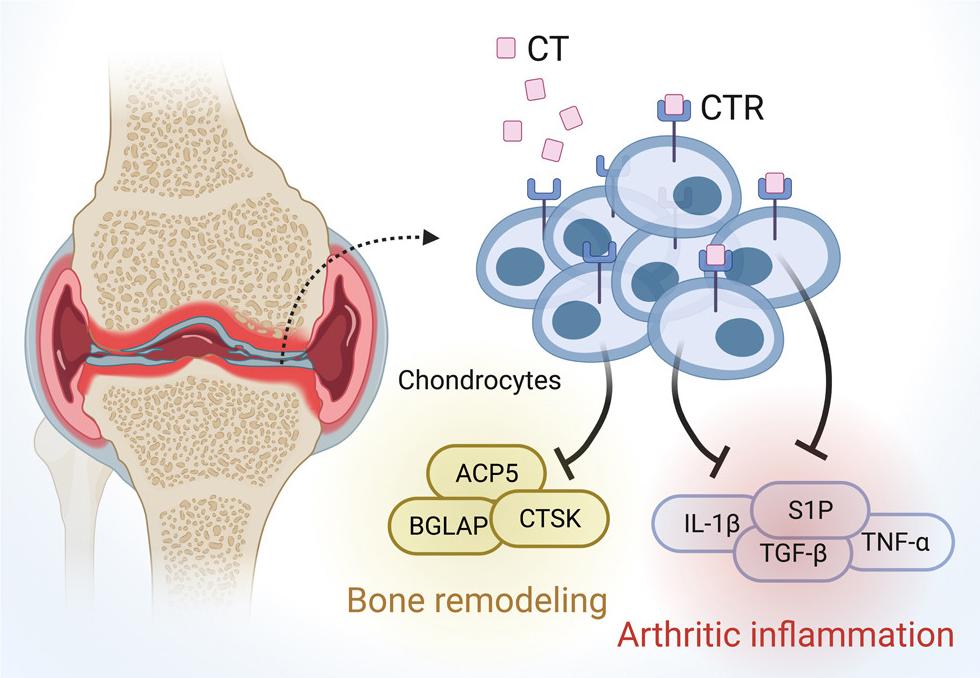 The calcitonin receptor guards prevent bone loss and inflammation